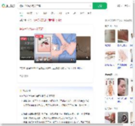 被蚊子咬后发热关节痛_360搜索